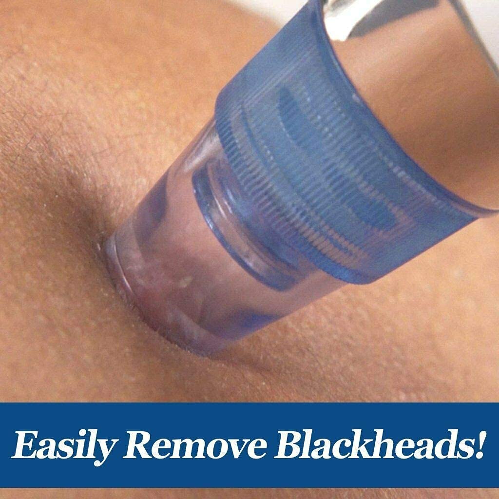4-in-1 Blackhead Extractor – Vacuum Suction Acne Remover & Pore Cleaner